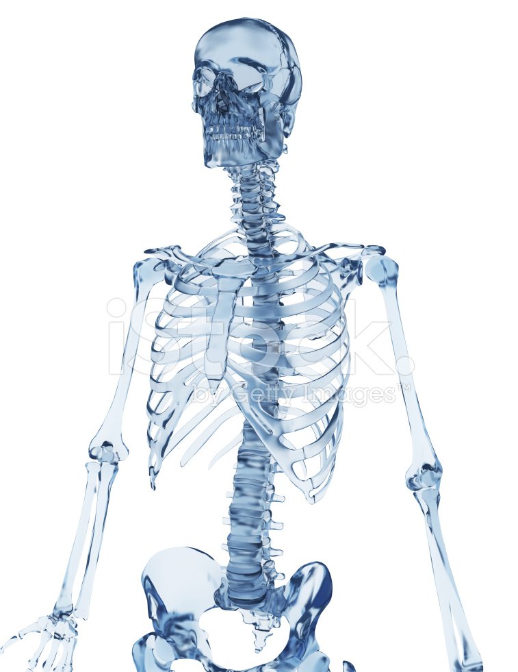 Osteogénesis imperfecta (OI), comúnmente conocida como «huesos de cristal»