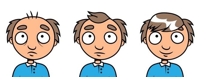 La molécula PP405 es un tratamiento tópico diseñado contra la alopecia