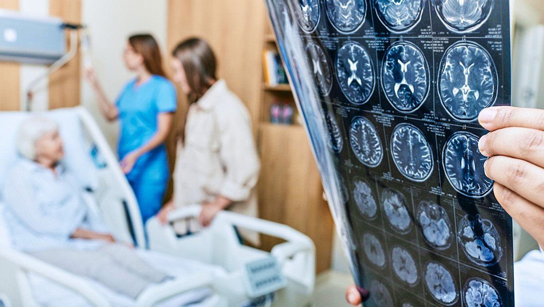 Combinación de compuestos naturales limpian el cerebro de 'proteínas Alzheimer'
