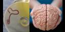 Escalofriante descubrimiento: identifican primer gusano parásito en cerebro humano
