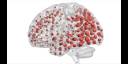 Científicos españoles descubren moléculas capaces de predecir el Alzheimer
