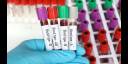 Este importante estudio con más de 5000 participantes evaluó la edad biológica de 11 órganos midiendo más de 4000 proteínas