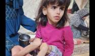 La niñez palestina también está muriendo por el hambre