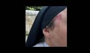 En el rostro de la monja los hematomas de la golpeadura. Foto en MEE suministrada por la policia israeli.