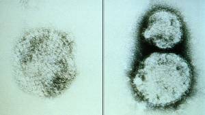 Hantavirus
