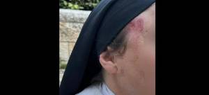 En el rostro de la monja los hematomas de la golpeadura. Foto en MEE suministrada por la policia israeli.
