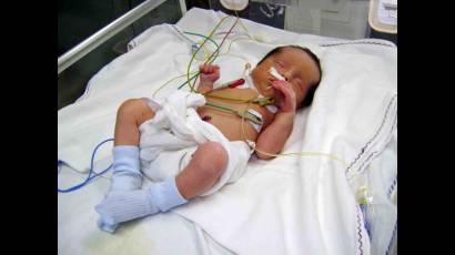 Médicos matanceros salvan bebé