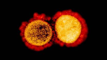 virus del SARS-CoV-2