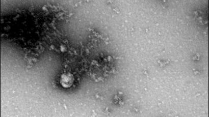 Foto de la nueva variante de coronavirus