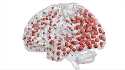 Científicos españoles descubren moléculas capaces de predecir el Alzheimer