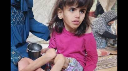 La niñez palestina también está muriendo por el hambre