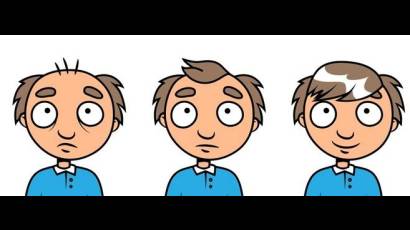 La molécula PP405 es un tratamiento tópico diseñado contra la alopecia