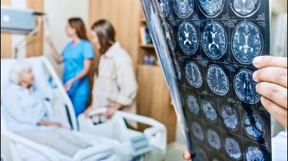 Combinación de compuestos naturales limpian el cerebro de 'proteínas Alzheimer'