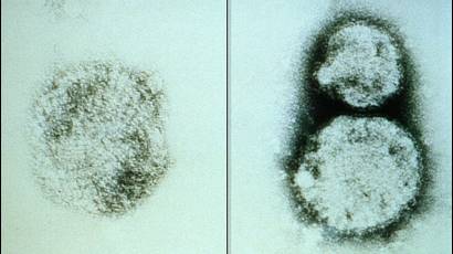 Hantavirus