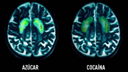 Protege a tu cerebro del azúcar