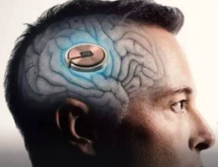 Neuralink implantó un chip cerebral por primera vez en un ser humano