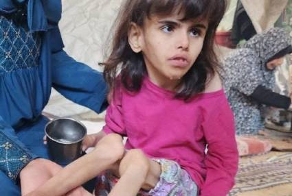 La niñez palestina también está muriendo por el hambre