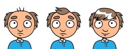 La molécula PP405 es un tratamiento tópico diseñado contra la alopecia