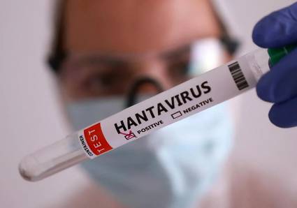 Hantavirus