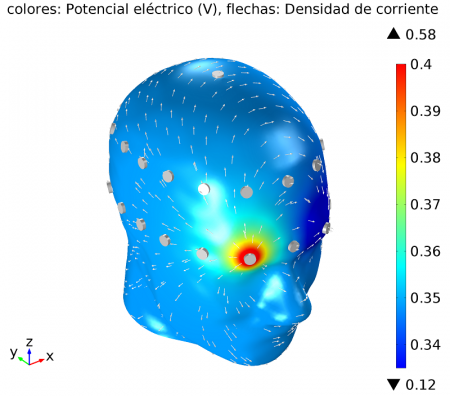 Un modelo computacional de cabeza humana a partir de elementos finitos les ha permitido obtener alentadores resultados en el diagnóstico diferencial de enfermedades cerebrovasculares. 