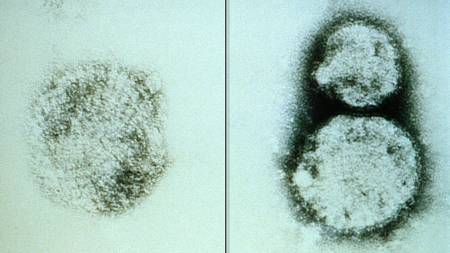 Hantavirus